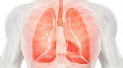 Asthma Treatment — Lungs Illustration in Yardley, PA