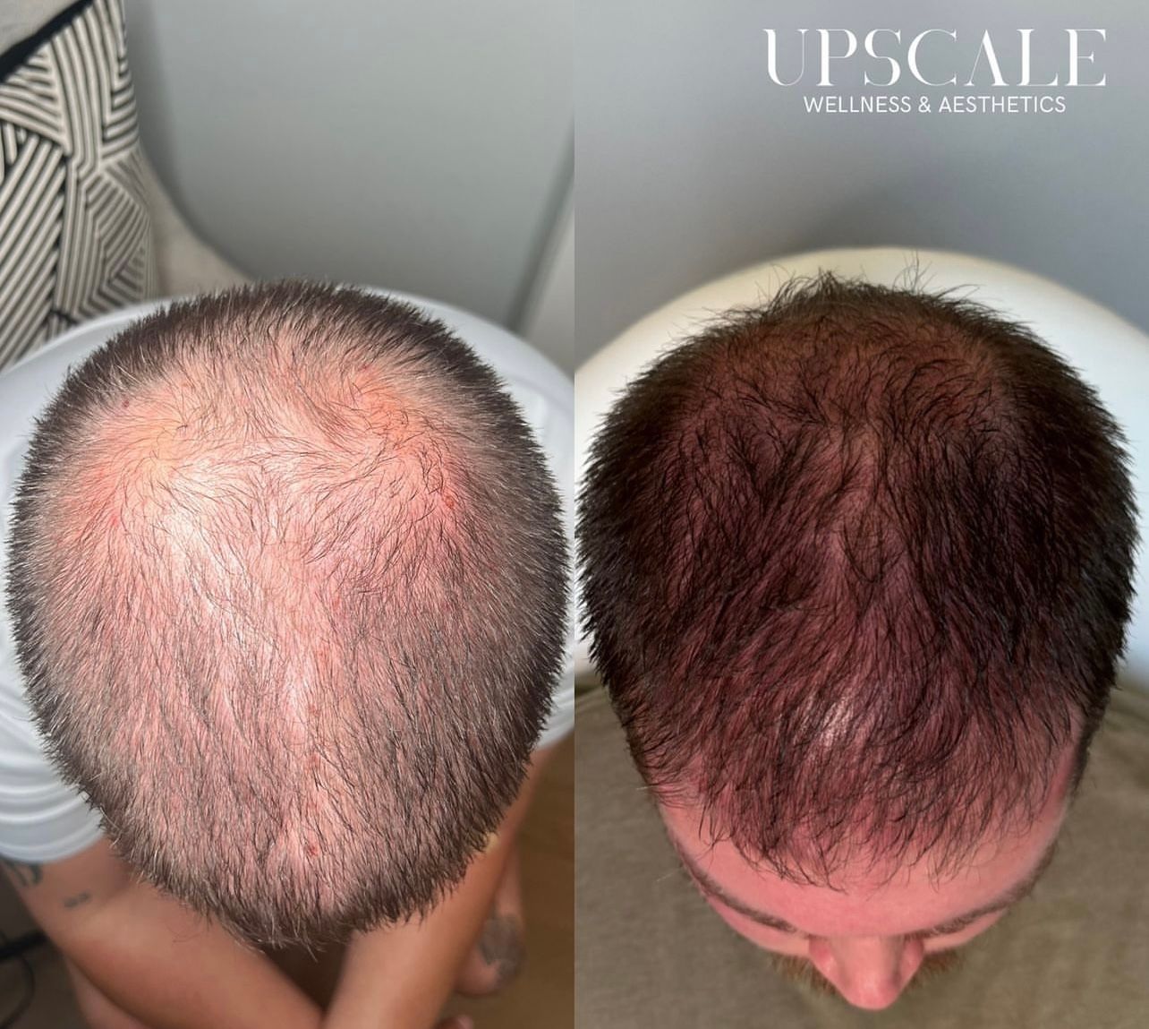 Hair Growth Oklahoma city 