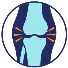 Blue knee joint with orange radiating lines, possibly illustrating pain.