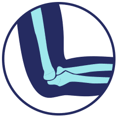 Elbow joint highlighted in light blue, inside a dark blue arm.