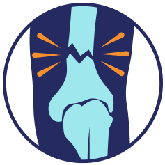 Broken bone illustration inside a blue circle; shows a light blue bone with orange radiating lines.