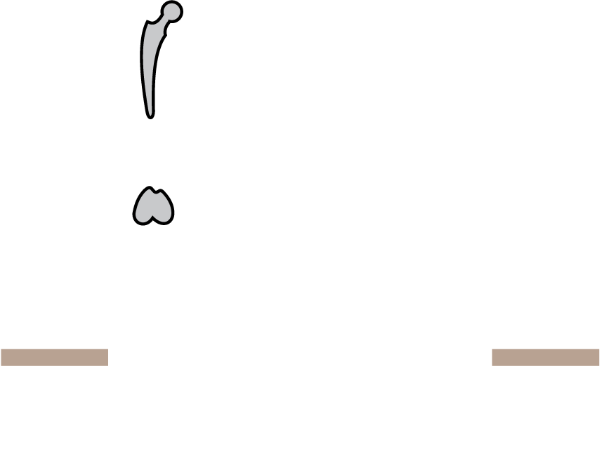 Joints from the bone in the 