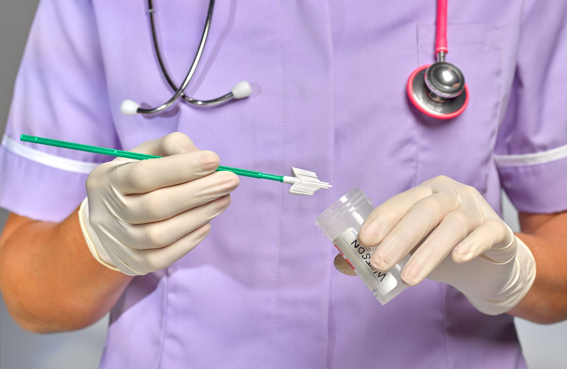 test diagnostico delle malattie a trasmissione sessuale
