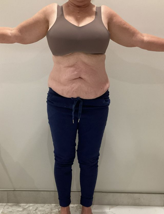 tirzepatide laredo tx Weight Loss | The Body Lab Med Spa
