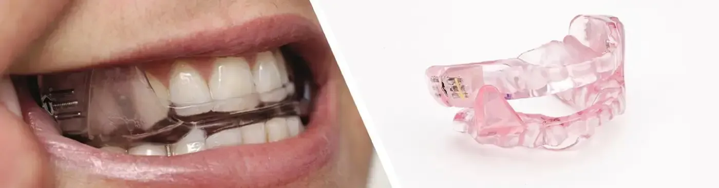 Dispositivo MAD Per smettere di russare