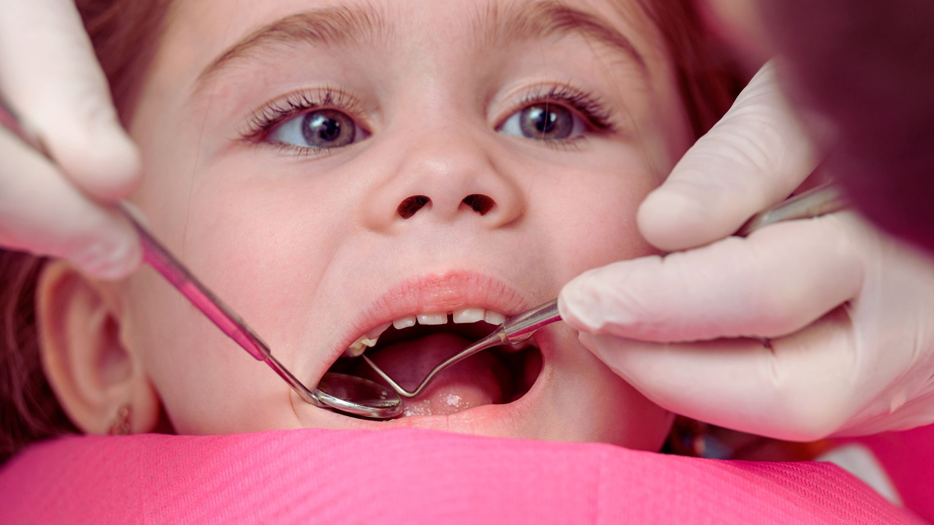 Una bambina si fa esaminare i denti da un dentista.