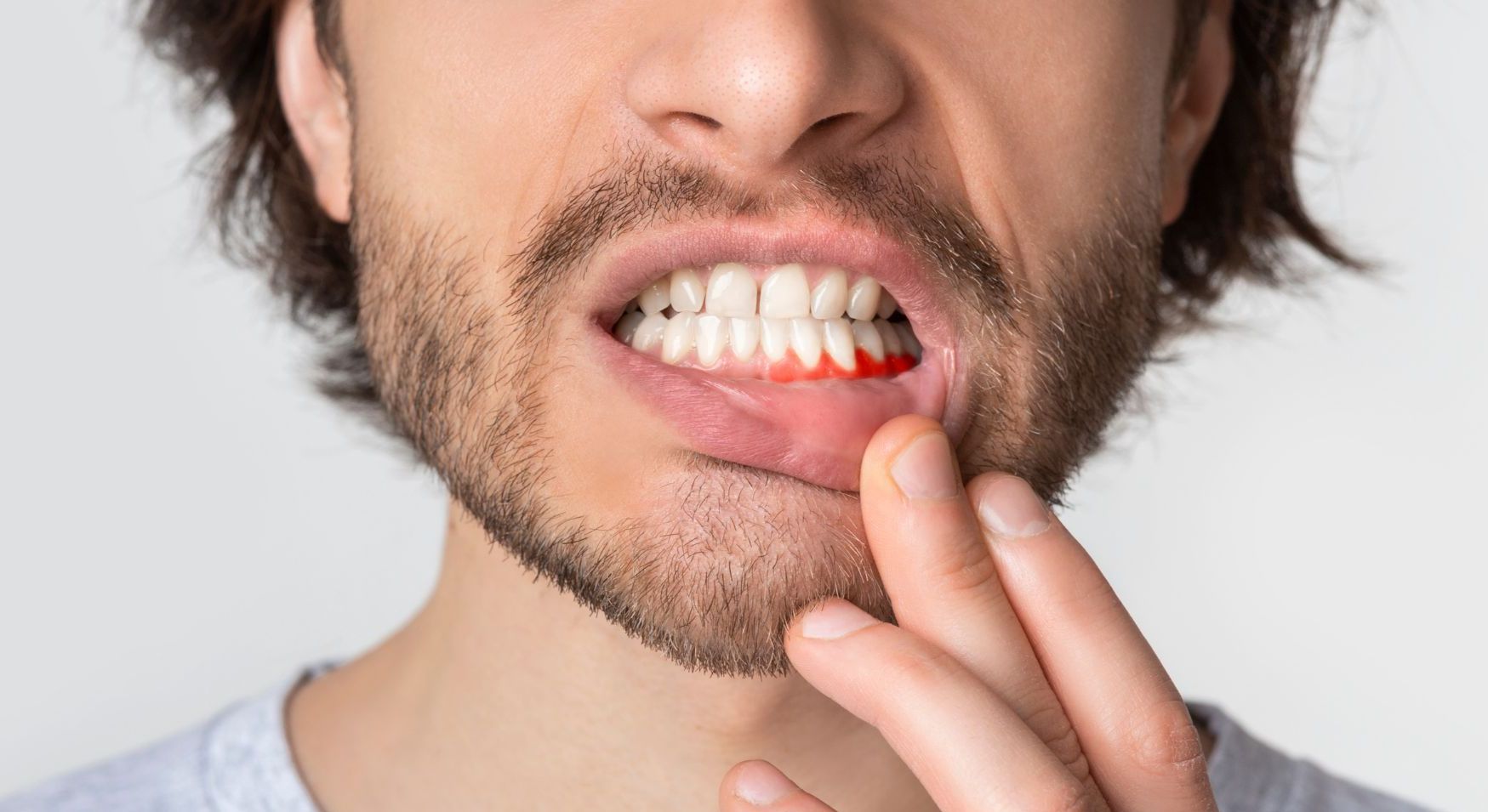 Un uomo con la barba si tiene la bocca per il dolore.
