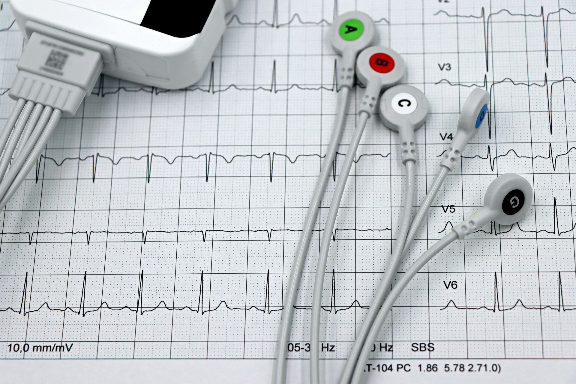 A close up of a heartbeat monitor and ecg cables