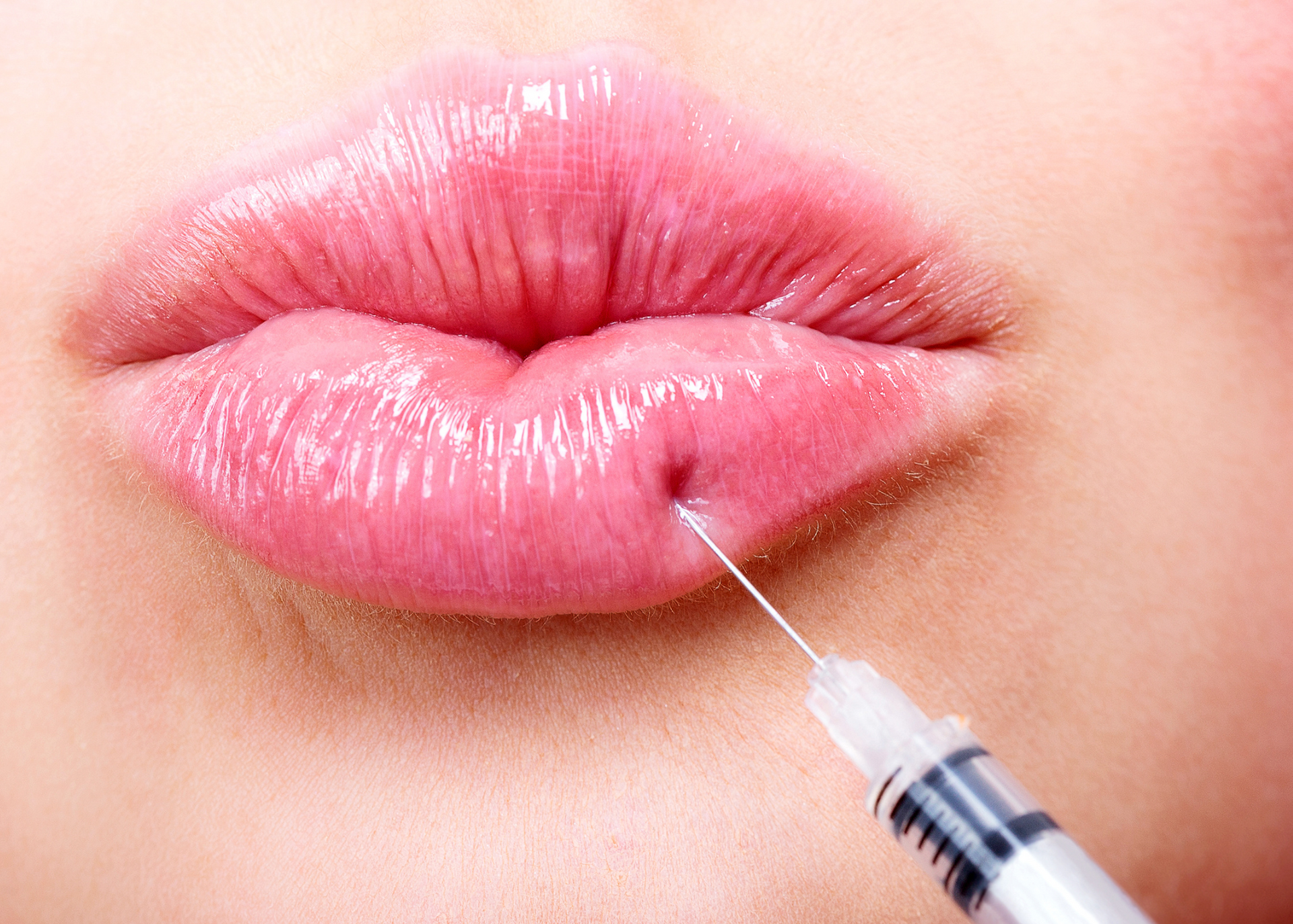 A woman is getting a botox injection in her lips.