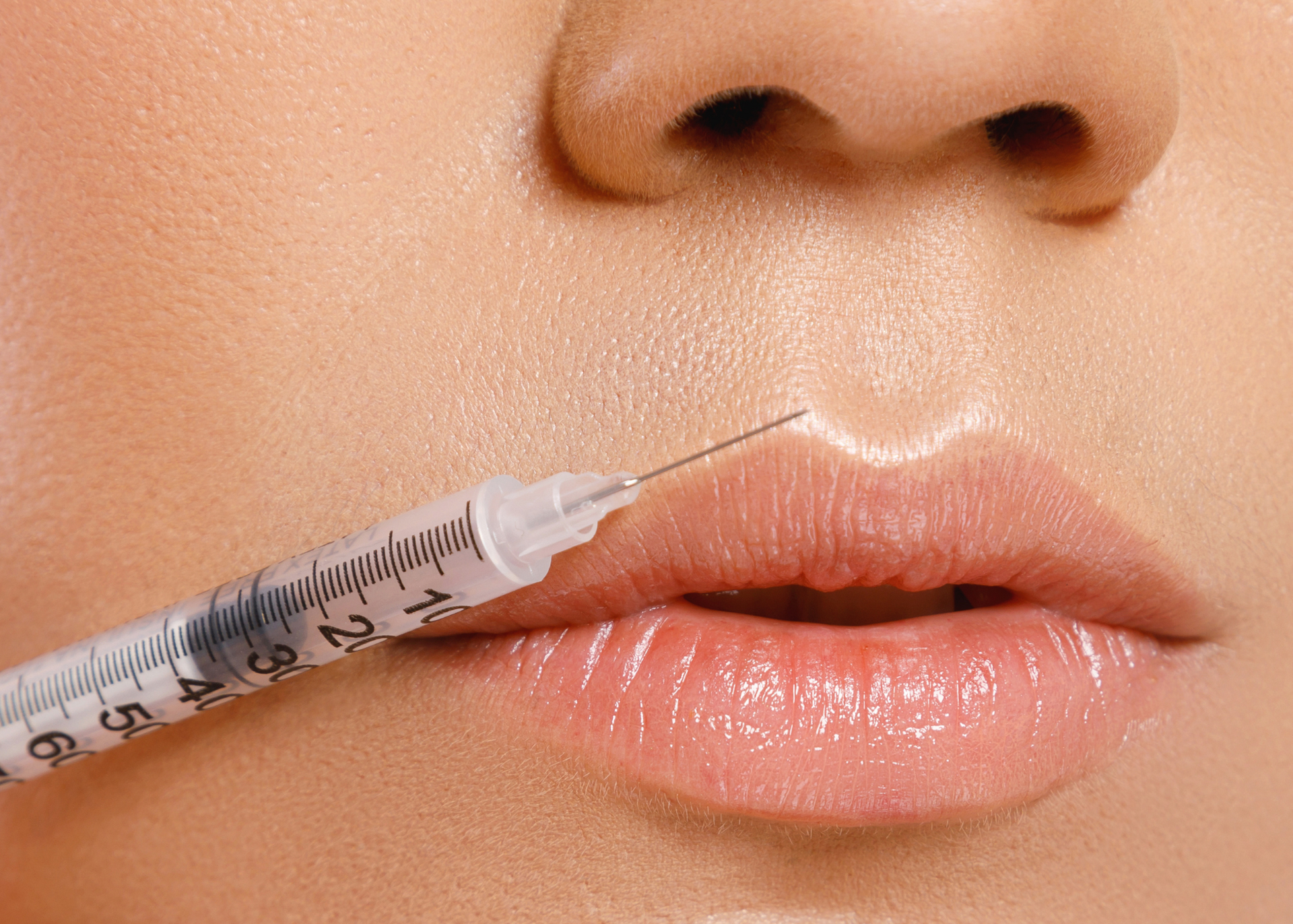 A woman is getting a botox injection in her lips.