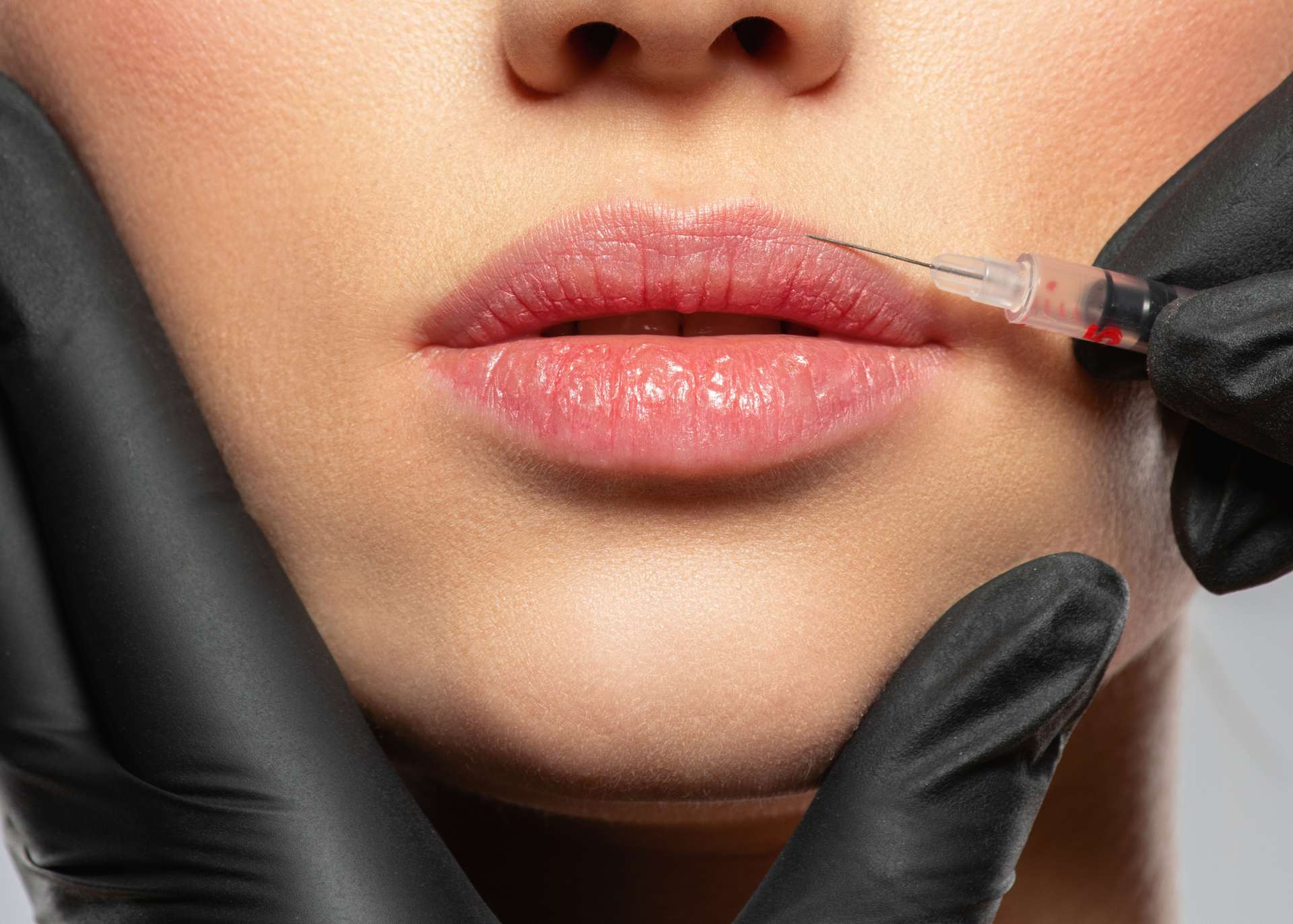 A woman is getting a botox injection in her lips.