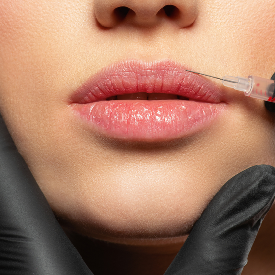 A woman is getting a botox injection in her lips.