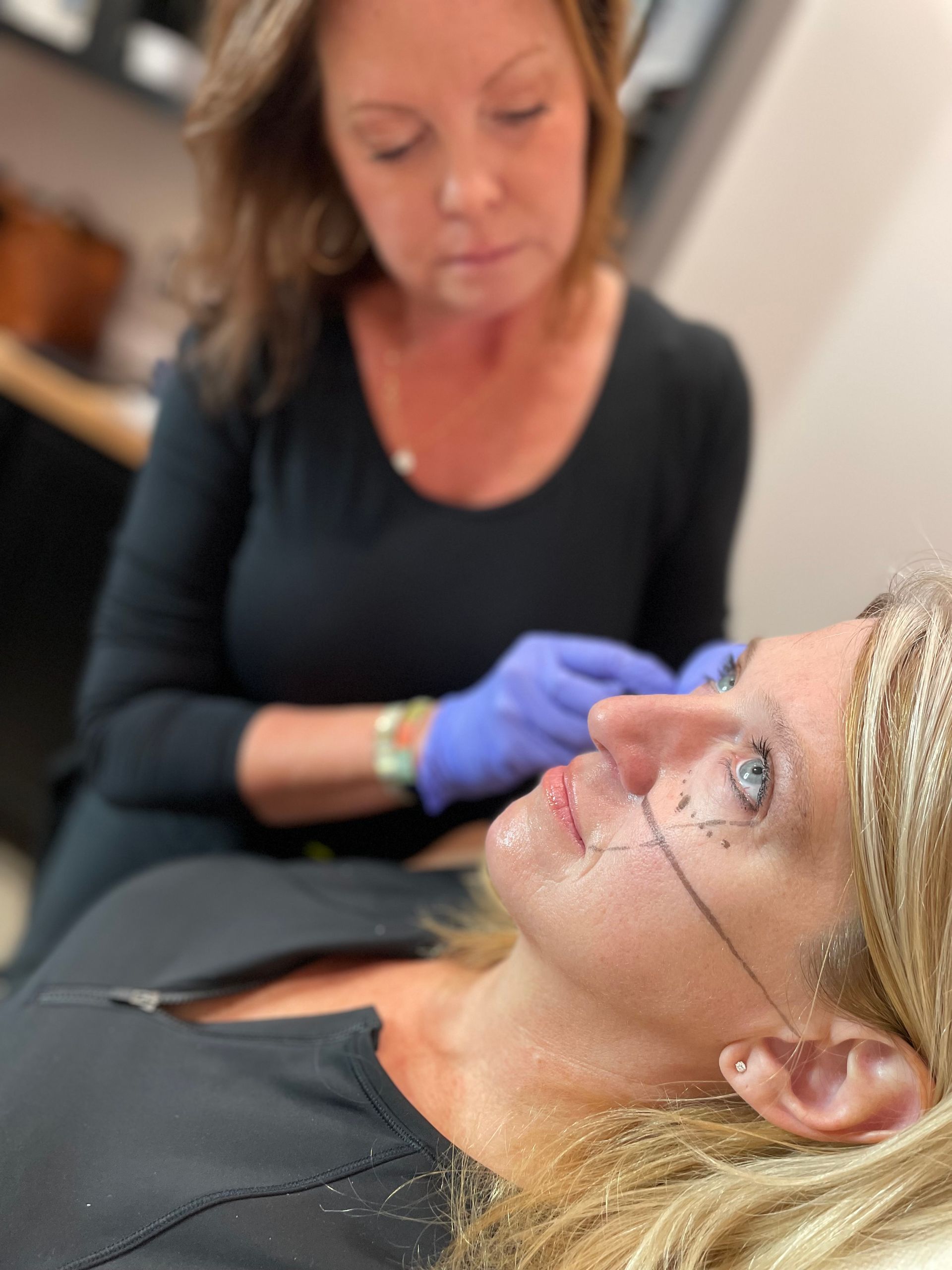 A woman is getting a botox injection in her face.