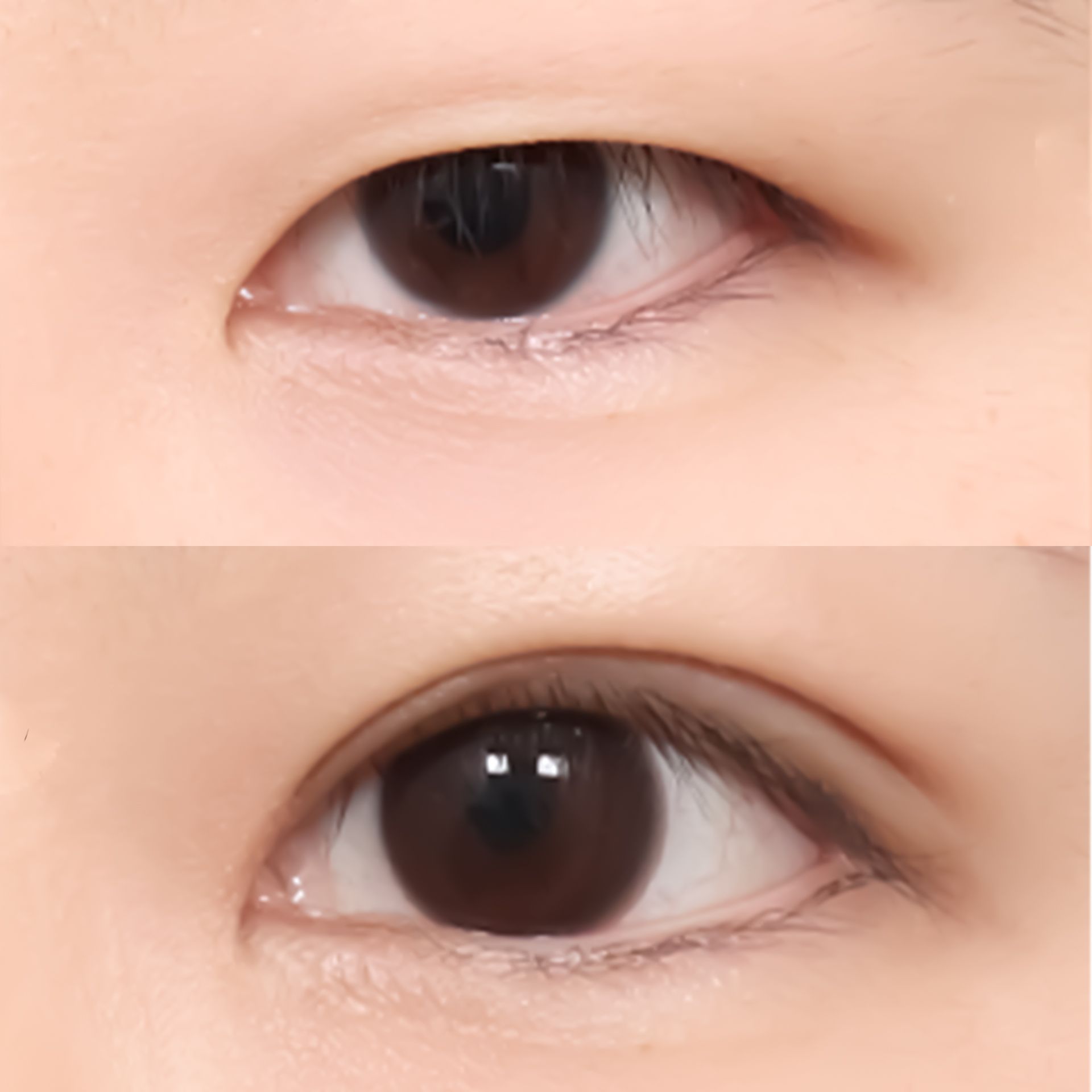 Two close-up views of brown eyes. The top eye has a small lid crease. The bottom eye has a defined lid crease.