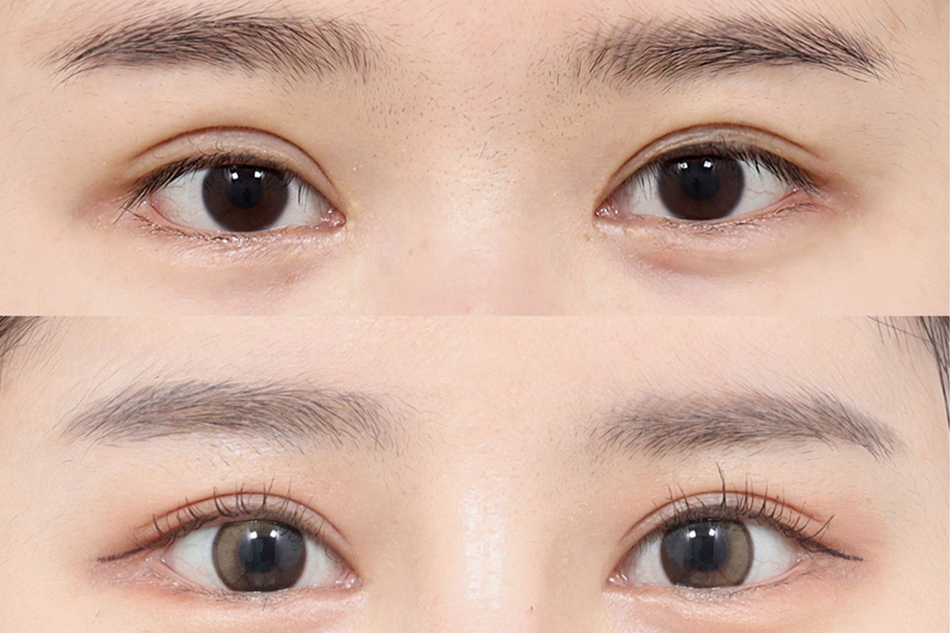 Two sets of eyes: before and after cosmetic procedure. Upper set shows closed eyelids; lower set, open eyes.