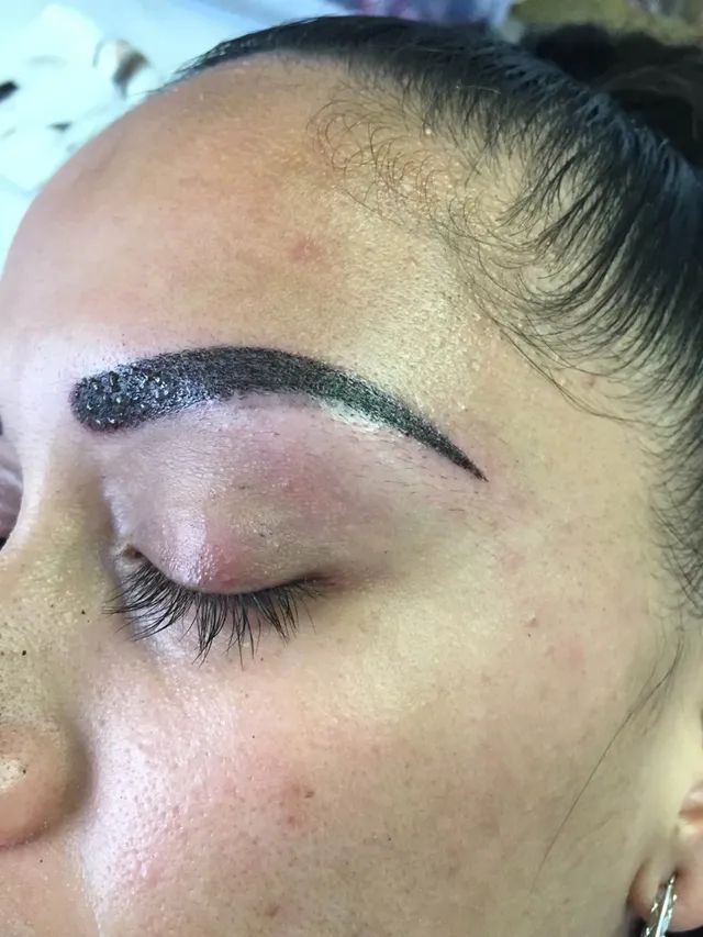  after permanent makeup
