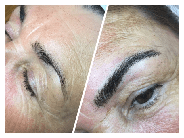 Before and after close up of one microbladed eyebrow
