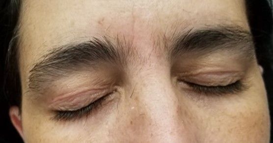 Eyebrows Before Shaping - North Little Rock, AR - Sherrye’s Esthetics and Wellness Spa