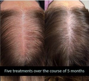 Brow Threading - North Little Rock, AR - Sherrye’s Esthetics and Wellness Spa