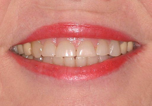 A close up of a woman 's mouth with white teeth and red lips.