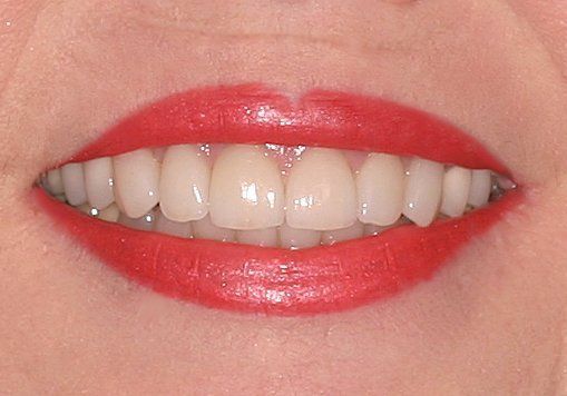 A close up of a woman 's mouth with red lipstick and white teeth.