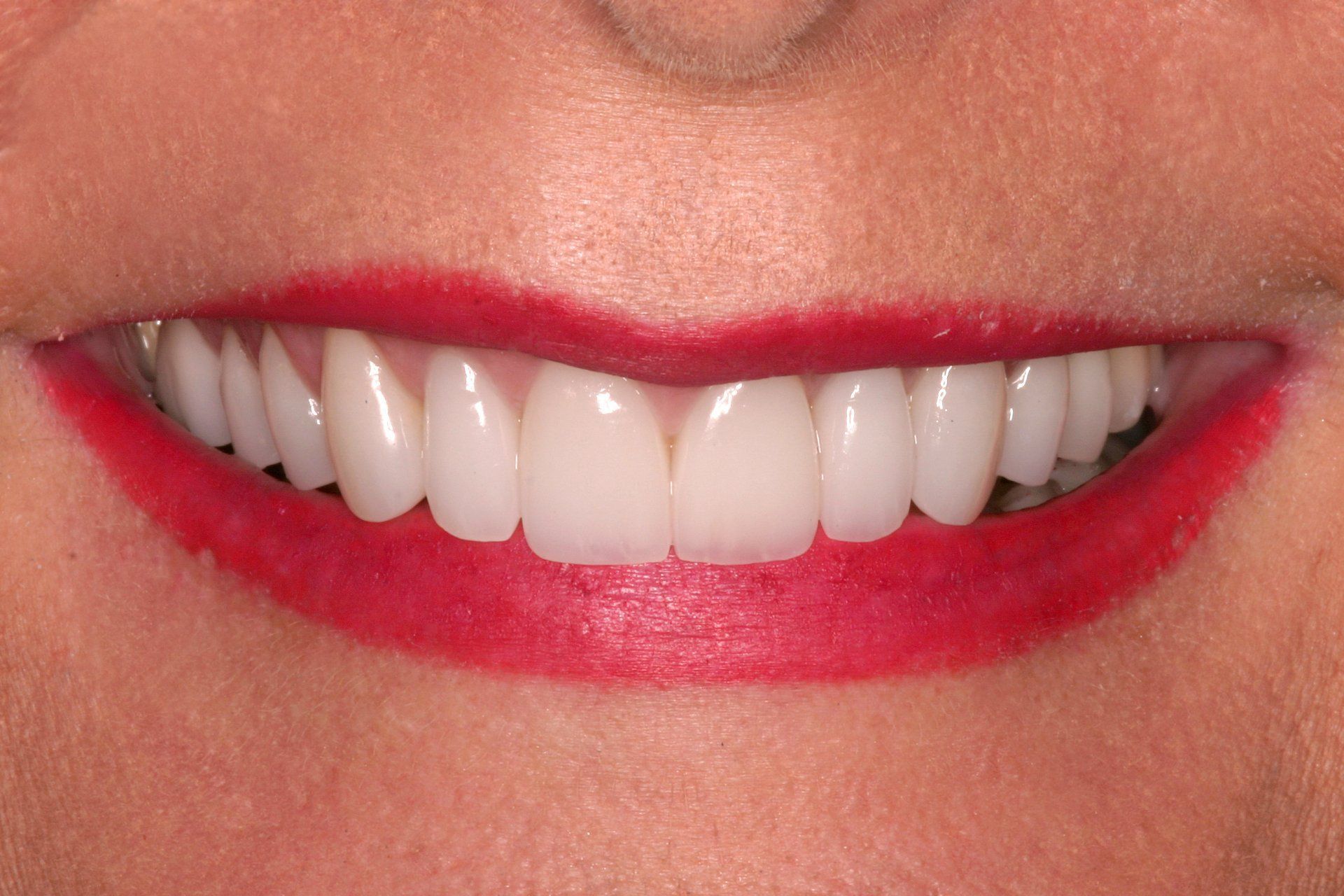 A close up of a woman 's smile with white teeth and red lipstick.