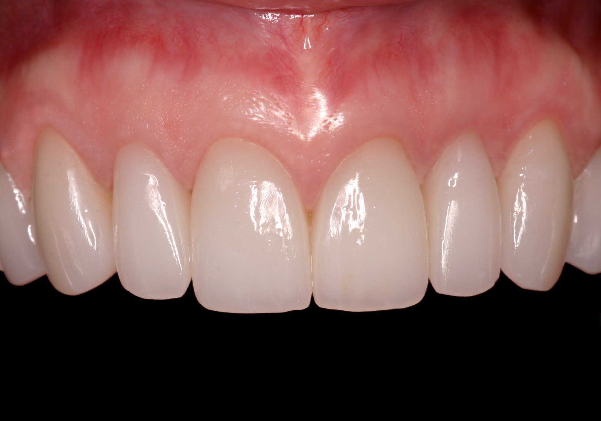 A close up of a person 's teeth with a black background.