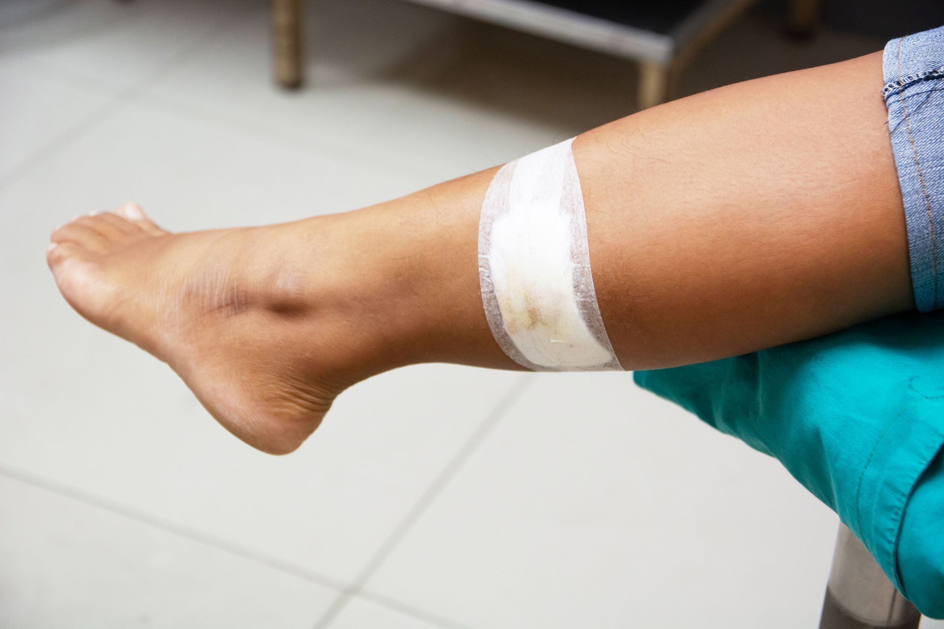 A woman’s leg with a bandage on a wound.