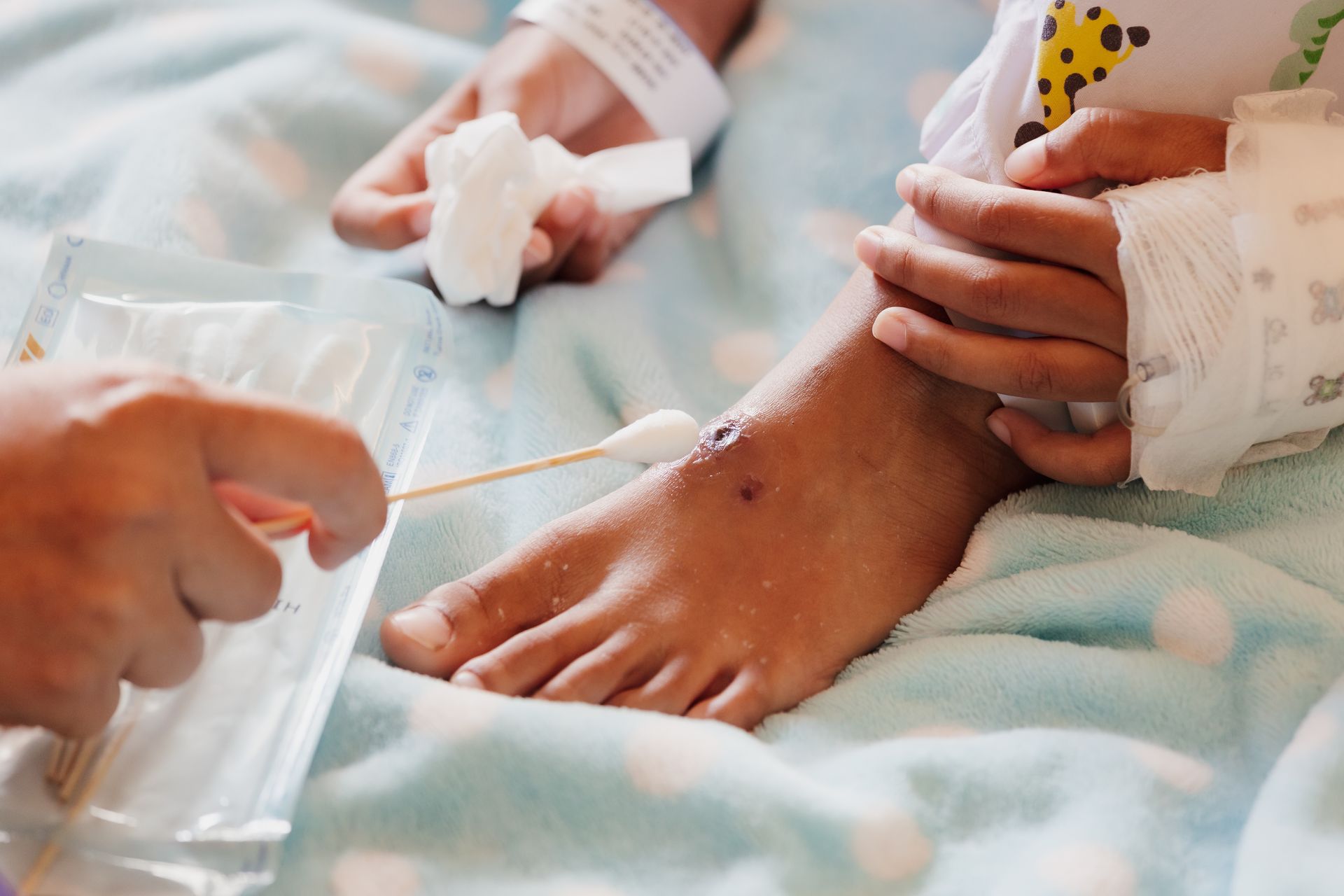 Doctor putting medicine on her wound while stay in private patient rooms. Doctor putting medicine on her wound while stay in private patient rooms.