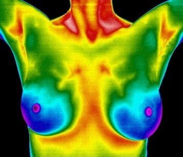 Breast Thermography - The naturopathic way - Connecticut