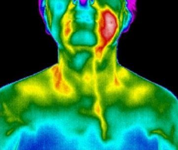 A thermal image of a person 's face and neck