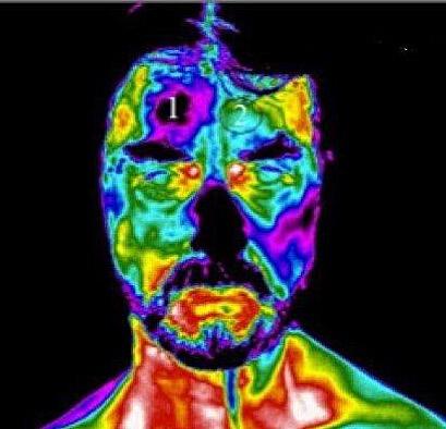 A thermal image of a man 's face and neck.