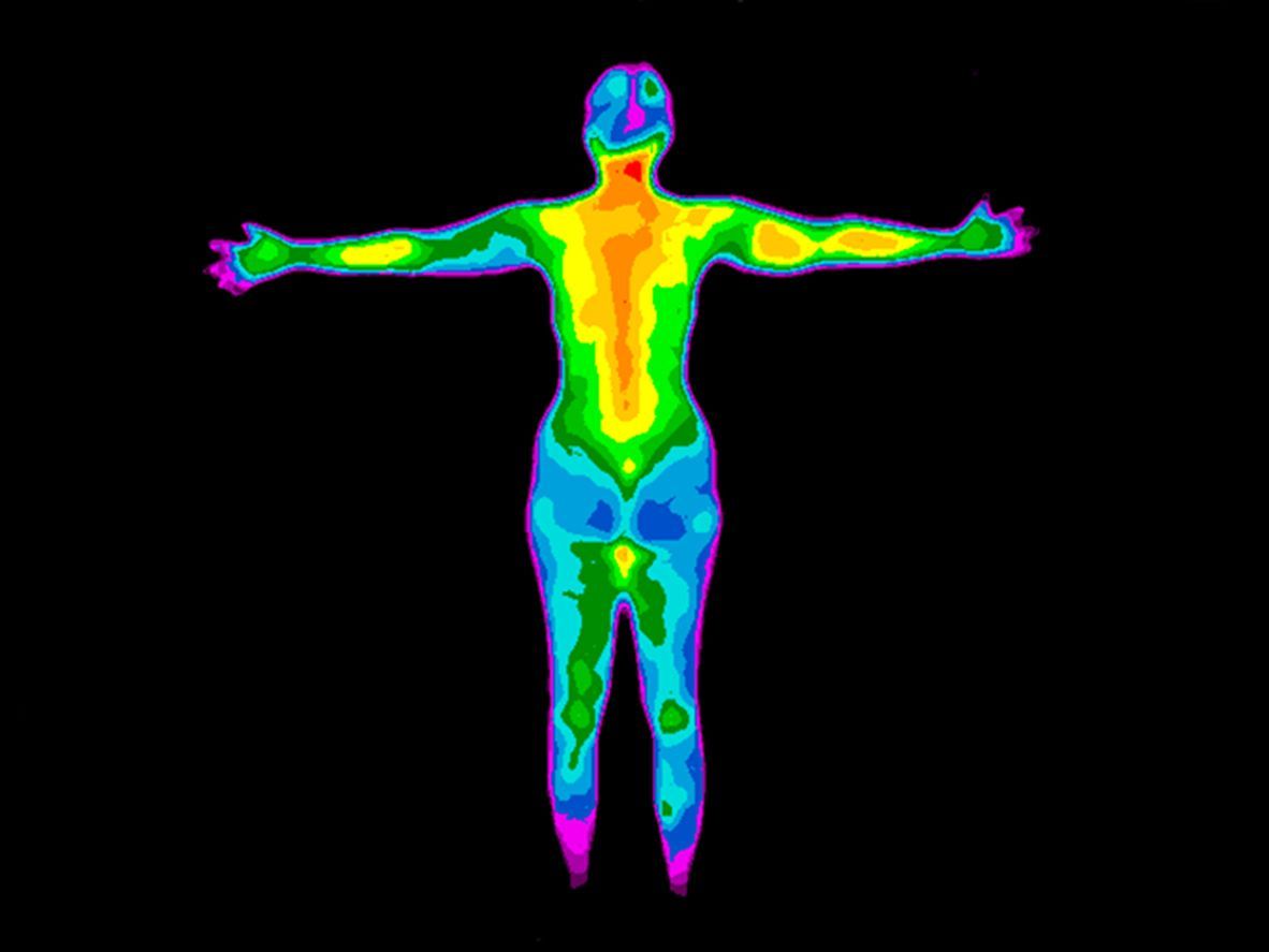 A thermographic inspections of the back of the whole body of a woman shows different temperatures.