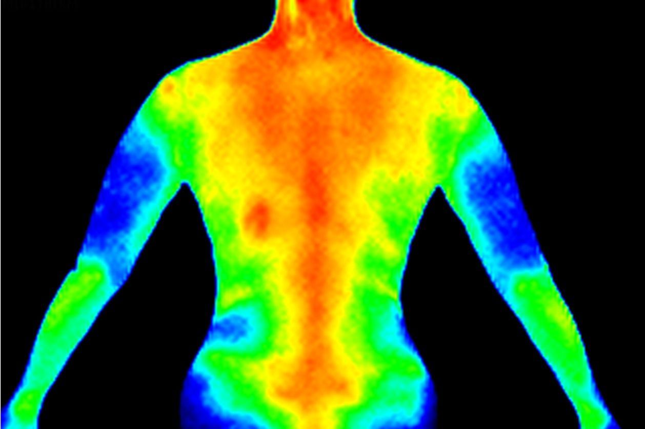 Thermography scan - Thermographic image of a person's back showing different temperature colors.