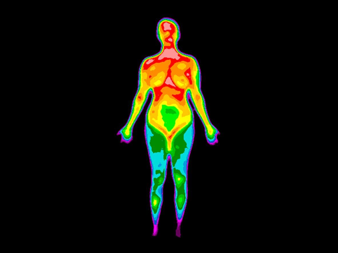 Photo of thermographic image of front of whole body of a woman with photo showing different temperat