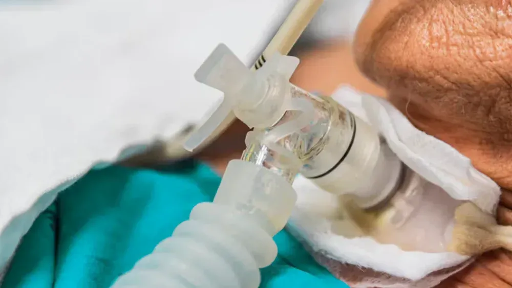 Tracheostomy Management & Airway Clearance