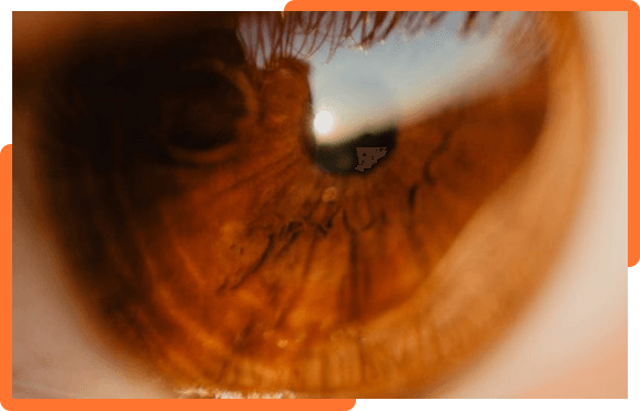 eye health