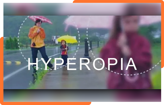 hyperopia