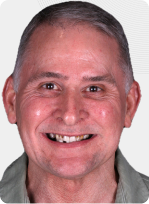 Man with gray hair smiling, missing a front tooth. Wearing a green shirt.