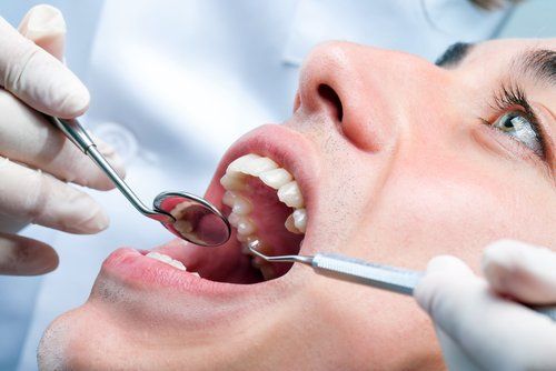 attrezzi dentista nella bocca di un uomo
