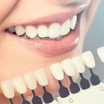 Dental Implants — Whitening Crowns in Louisville, Kentucky