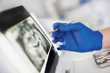 Dental x-ray — Armadale, WA — Acorn Dental Centre