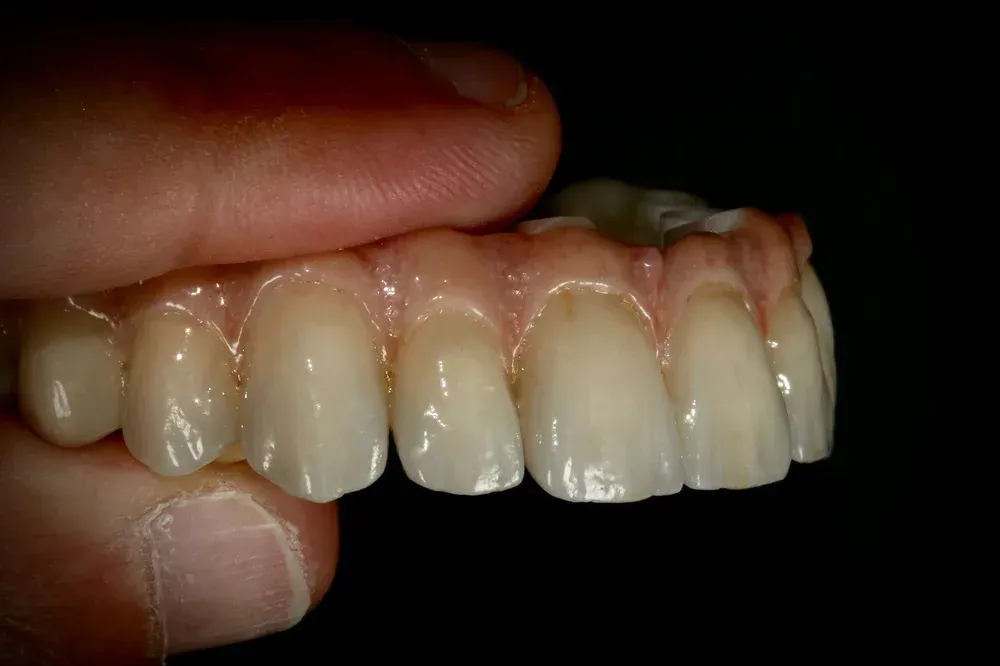 A set of upper dentures held between fingers, showing artificial teeth and gum-colored base against a dark background. — AB Esthetic Dental Laboratory in Brisbane, QLD