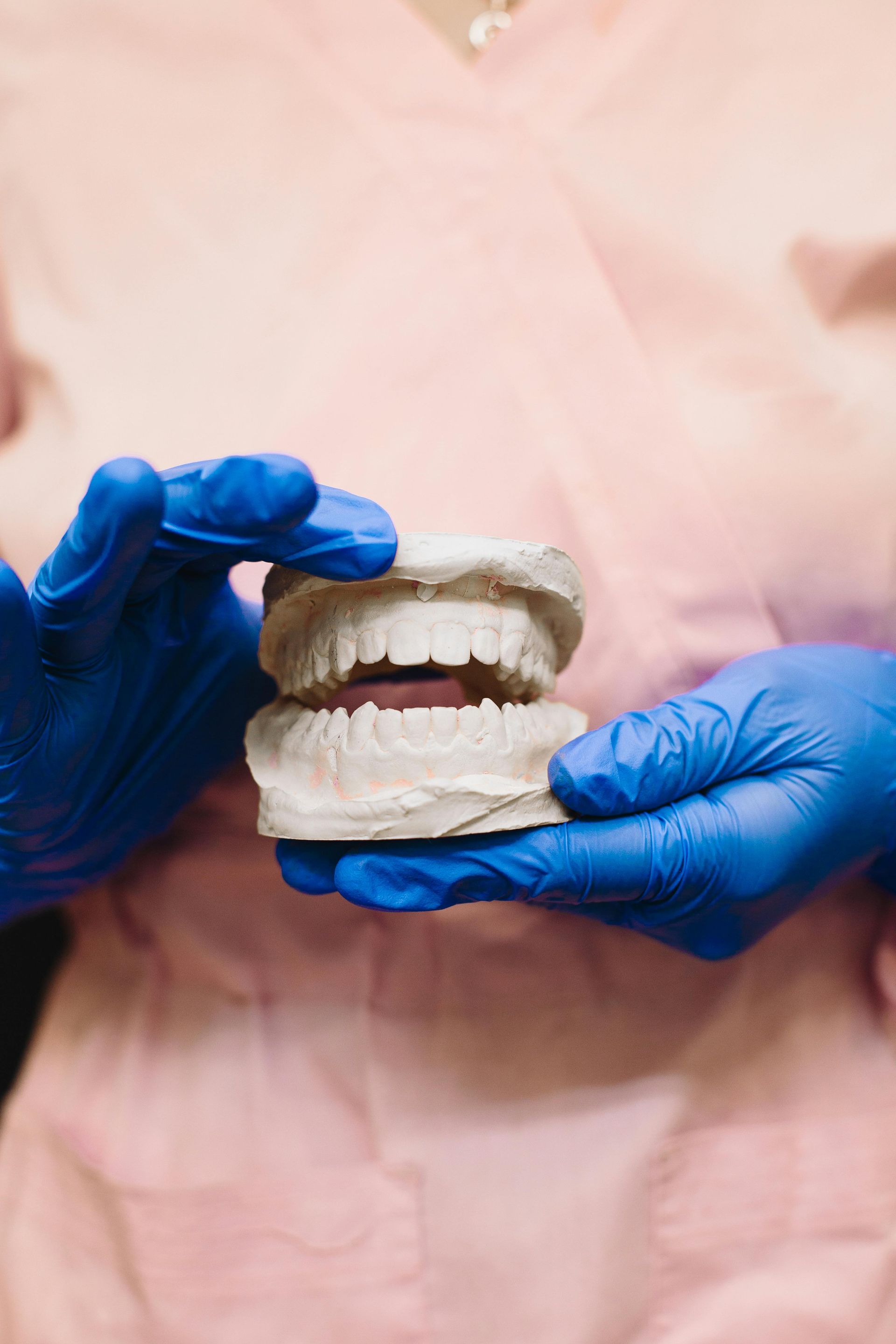 Hands in Blue Gloves Holding Plaster Dental — AB Esthetic Dental Laboratory in Brisbane, QLD