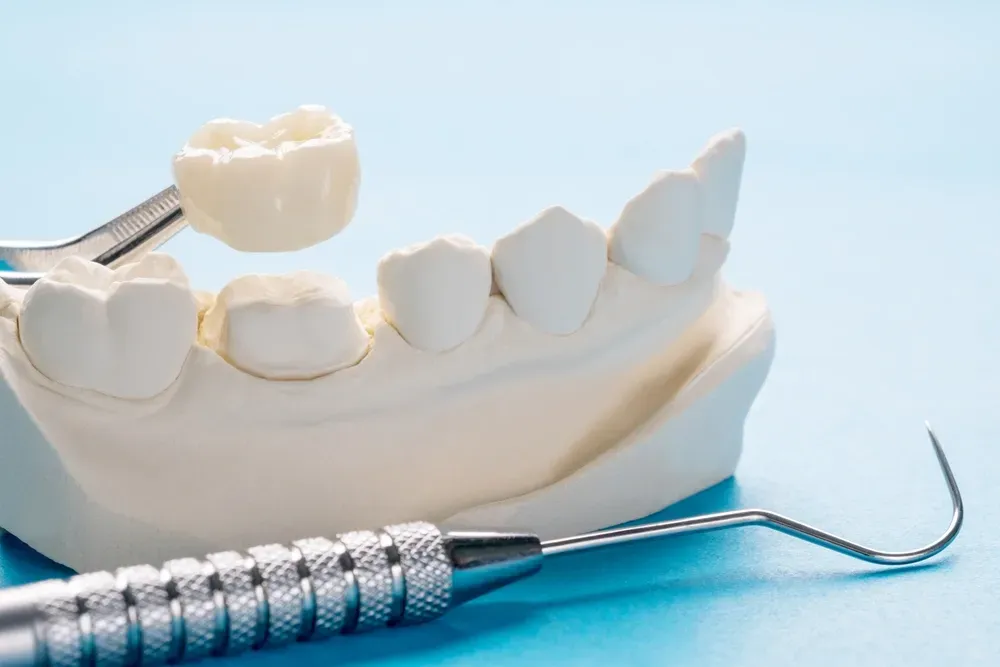 Dental model with a crown and dental tools on a blue surface. — AB Esthetic Dental Laboratory in Brisbane, QLD
