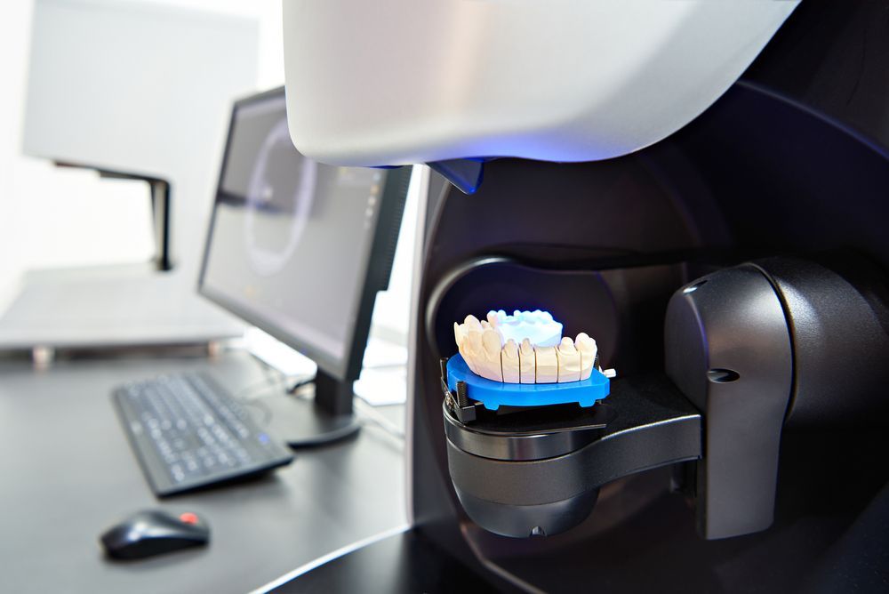 Dental Scanner Capturing a Blue Dental Mold — AB Esthetic Dental Laboratory in Sunshine Coast, QLD