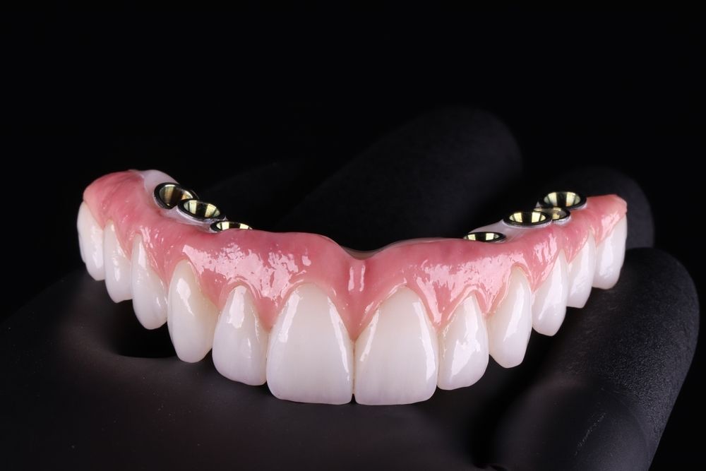 A set of upper dental implants with artificial teeth, held by a gloved hand against a black background. — AB Esthetic Dental Laboratory in Robina, QLD