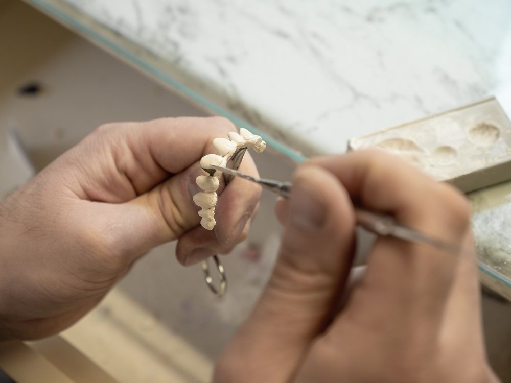 Hands holding dental bridge, meticulously working with small tools in a dental lab. — AB Esthetic Dental Laboratory in Robina, QLD