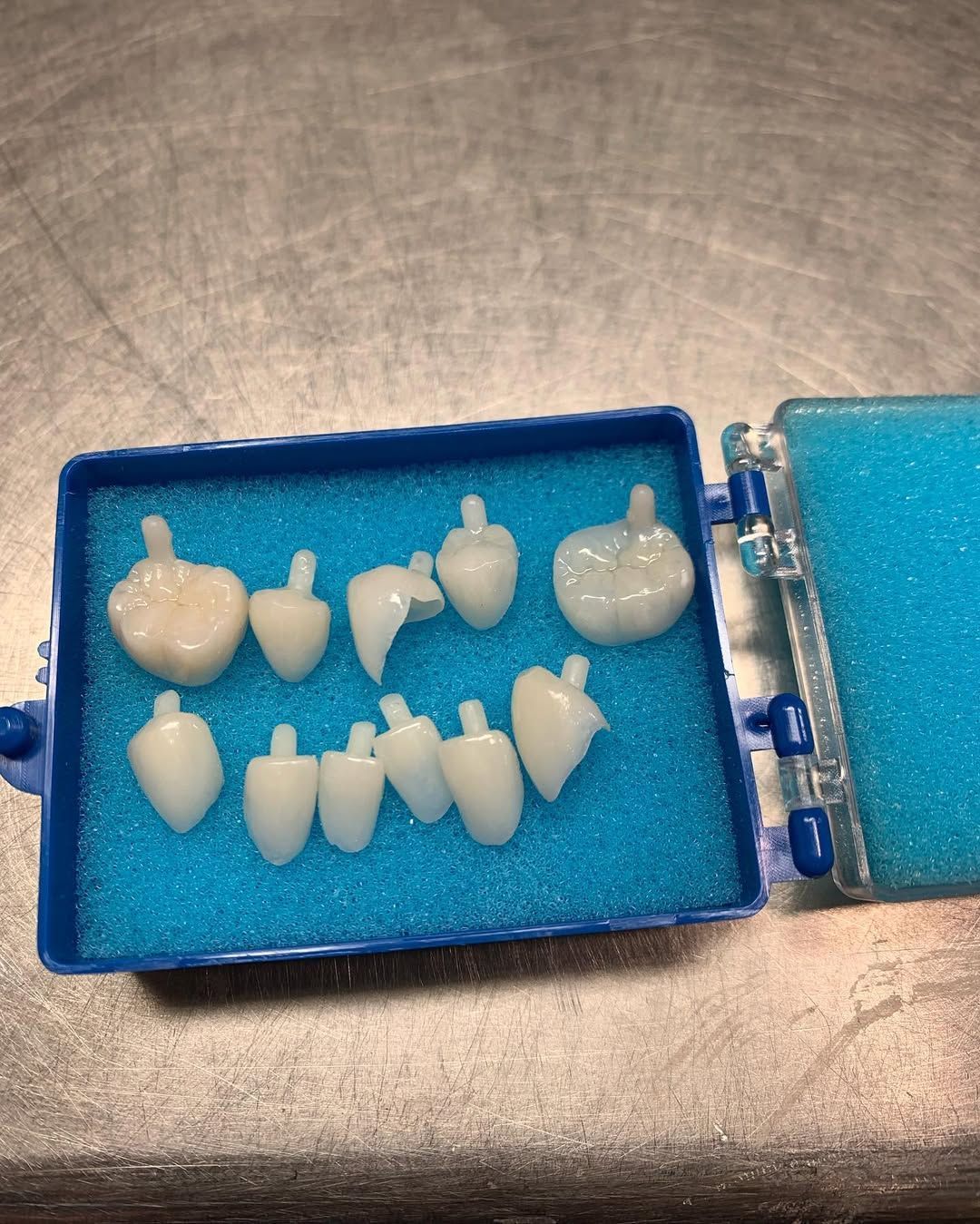 Dental crowns arranged in a blue case with blue foam. — AB Esthetic Dental Laboratory in Robina, QLD