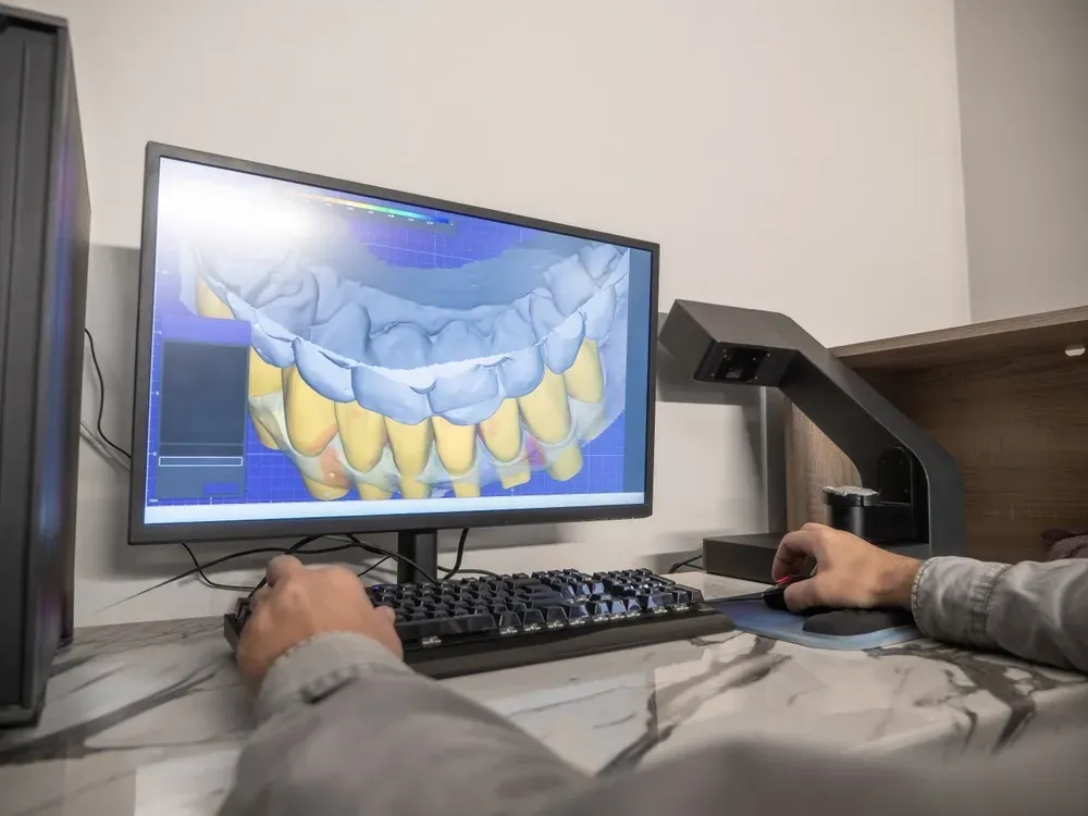 Person using computer software displaying a 3D dental model; black keyboard, mouse, and scanner visible. — AB Esthetic Dental Laboratory in Sunshine Coast, QLD